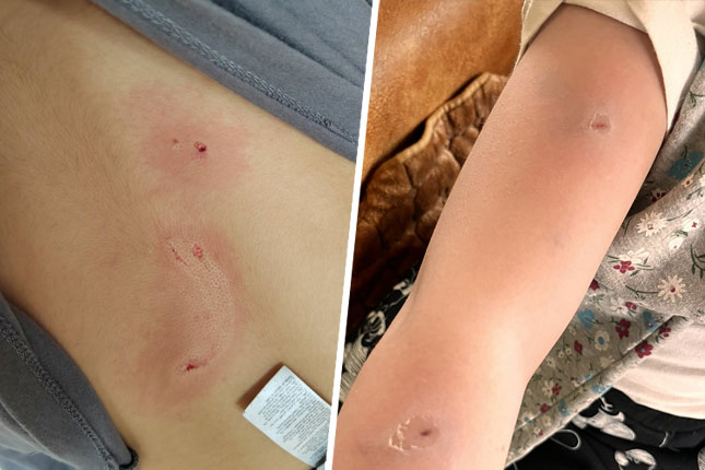 Ogorčeni roditelji dece koju su izujedali belgijski ovčari, protiv vlasnika biće podneta krivična prijava