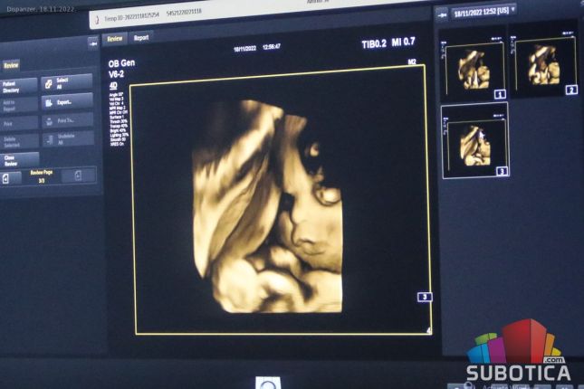 Dispanzer za žene dobio najsavremeniji ultrazvučni aparat