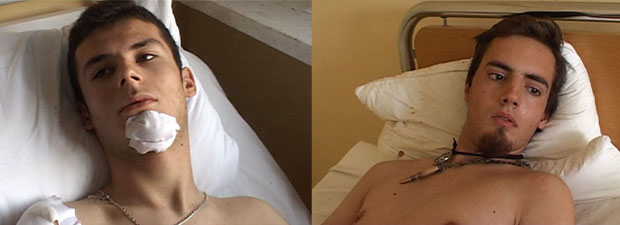 Na tri lokacije napadnute tri osobe i nanešene im teške telesne povrede