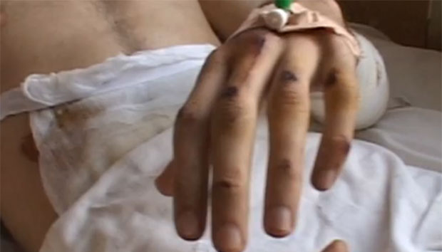 Na tri lokacije napadnute tri osobe i nanešene im teške telesne povrede