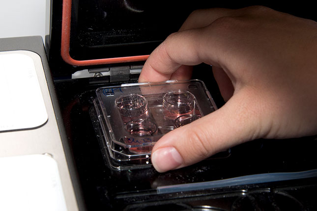 Zamrzavanje polnih ćelija i embriona - kako to izgleda u praksi