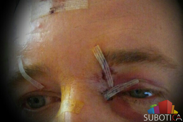 Napadnut taksista na Prozivci