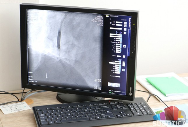 Intervencije na srcu uz pomoć najmodernije opreme i vrhunskih stručnjaka