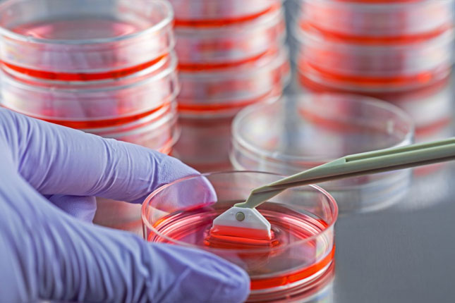 Istrči trku humanosti, upiši se u Registar dobrovoljnih davalaca matičnih ćelija hematopoeze!