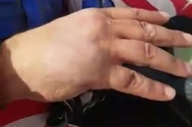 Sagmajster ponovo polomio šaku, ali nastavlja Dakar