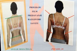 Najava obeležavanja Svetskog dana kičmenog stuba