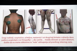 Najava obeležavanja Svetskog dana kičmenog stuba