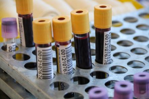 Akcija dobrovoljnog davanja krvi u organizaciji Studentskog parlamenta