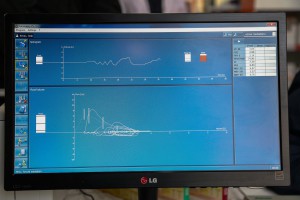 Besplatni spirometrijski pregledi