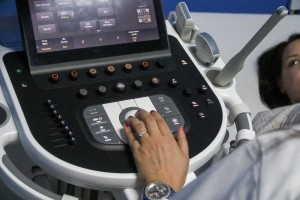 Novi 4D ultrazvuk na odeljenu ginekologije u Dispanzeru za žene