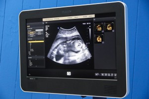 Novi 4D ultrazvuk na odeljenu ginekologije u Dispanzeru za žene